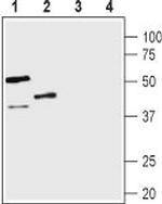 Vasopressin V1B Receptor (AVPR1B) Antibody in Western Blot (WB)