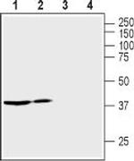 Vasopressin V2 Receptor (AVPR2) Polyclonal Antibody