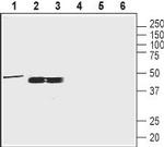 Oxytocin Receptor Antibody in Western Blot (WB)