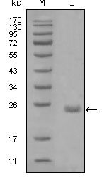 Axl Monoclonal Antibody (1B3A2)