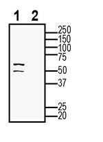 ZnT4 (SLC30A4) Antibody in Western Blot (WB)