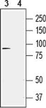 TRPV4 Antibody in Western Blot (WB)