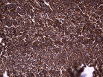 Acidic Cytokeratin Antibody in Immunohistochemistry (Paraffin) (IHC (P))