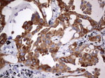 Acidic Cytokeratin Antibody in Immunohistochemistry (Paraffin) (IHC (P))