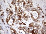Acidic Cytokeratin Antibody in Immunohistochemistry (Paraffin) (IHC (P))