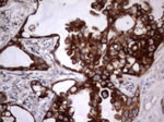Acidic Cytokeratin Antibody in Immunohistochemistry (Paraffin) (IHC (P))