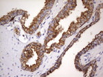 Acidic Cytokeratin Antibody in Immunohistochemistry (Paraffin) (IHC (P))