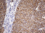 Acidic Cytokeratin Antibody in Immunohistochemistry (Paraffin) (IHC (P))