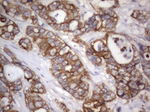 Acidic Cytokeratin Antibody in Immunohistochemistry (Paraffin) (IHC (P))