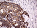 Acidic Cytokeratin Antibody in Immunohistochemistry (Paraffin) (IHC (P))