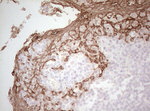 Basic Cytokeratin Antibody in Immunohistochemistry (Paraffin) (IHC (P))