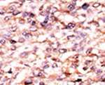 ACVR1C Antibody in Immunohistochemistry (IHC)