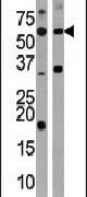 ACVR1C Antibody in Western Blot (WB)