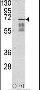 ACVR1 Antibody in Western Blot (WB)