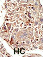 ACVR1 Antibody in Immunohistochemistry (IHC)