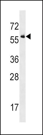 ACVR1 Antibody in Western Blot (WB)