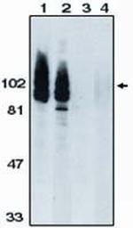 ADAM17 Antibody in Western Blot (WB)