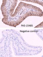 Adenylate Kinase 1 Antibody in Immunohistochemistry (IHC)