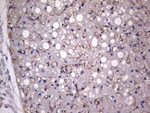 Adiponectin Antibody in Immunohistochemistry (Paraffin) (IHC (P))
