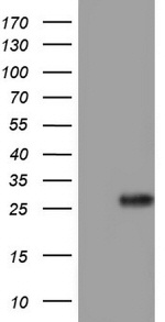 Adiponectin Antibody in Western Blot (WB)