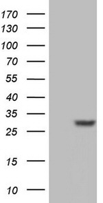 Adiponectin Antibody in Western Blot (WB)