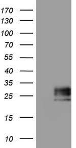 Adiponectin Antibody in Western Blot (WB)