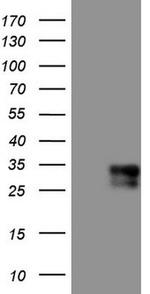 Adiponectin Antibody in Western Blot (WB)