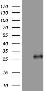 Adiponectin Antibody in Western Blot (WB)