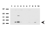 Adiponectin Antibody in Western Blot (WB)