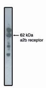 alpha-2b Adrenergic Receptor Monoclonal Antibody (5G10)