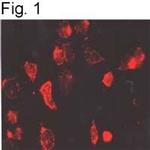 beta-1 Adrenergic Receptor Antibody in Immunohistochemistry (IHC)