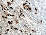 POMC Antibody in Immunohistochemistry (IHC)