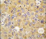 alanyl-tRNA Synthetase Antibody in Immunohistochemistry (IHC)