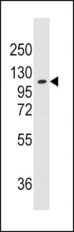 alanyl-tRNA Synthetase Antibody in Western Blot (WB)