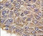 Aldolase A Antibody in Immunohistochemistry (IHC)