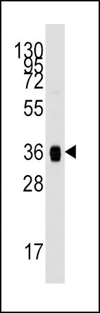 Aldolase A Antibody in Western Blot (WB)