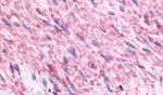 alpha-2c Adrenergic Receptor Antibody in Immunohistochemistry (Paraffin) (IHC (P))