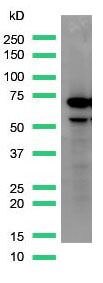 AFP Antibody in Western Blot (WB)