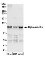 Alpha-adaptin Antibody in Western Blot (WB)