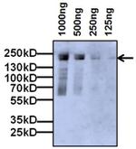A2M Monoclonal Antibody (F1-P1C11 #3)