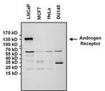 Androgen Receptor Antibody in Western Blot (WB)
