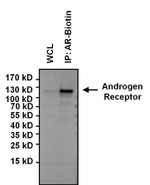 Androgen Receptor Antibody in Immunoprecipitation (IP)