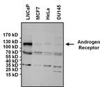 Androgen Receptor Antibody in Western Blot (WB)