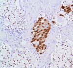 Androgen Receptor Antibody in Immunohistochemistry (Paraffin) (IHC (P))