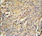 Annexin A1 Antibody in Immunohistochemistry (IHC)