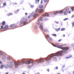 Annexin A1 Antibody in Immunohistochemistry (IHC)