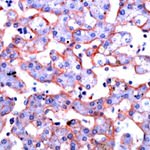 Annexin A6 Antibody in Immunohistochemistry (IHC)