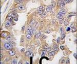 AGR2 Antibody in Immunohistochemistry (IHC)