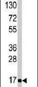 AGR2 Antibody in Western Blot (WB)