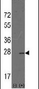 AGR2 Antibody in Western Blot (WB)